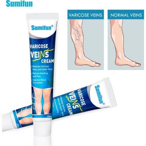 2pcs Varicose Veins Treatment Cream Angiitis Removal Patch Vasculitis Phlebitis Spider Leg Ointment Herb Medical Plaster P1234
