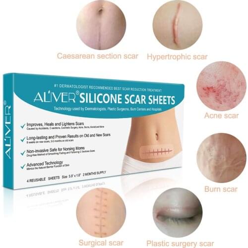 Efficient Beauty Scar Removal Silicone Gel Self-Adhesive Silicone Gel Patch for Acne Burn Cesarean Section Keloid Scar Reduce