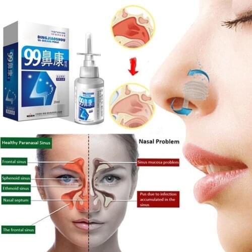 20ml Chinese Traditional Medical Nose Care Herb Spray Sinusitis Rhinitis Medicines Treatment Spray Nasal Spray Rhinitis X8I0
