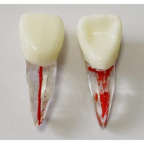 5~100Pis 11# Dental Endo Files Practise Model File Training Root Canal Crown Pulp Not Opened