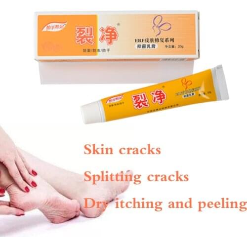 ZB Foot Crack Repair ointment Repair foot Crack Whitening smooth Cream Cracked Hands Feet Dry Skin Moisturizing Skin Care