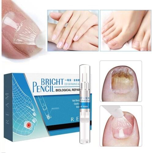 4Pcs Fungus Nail Treatment Repair Pen Fungus Nail Repair Pen Eliminator for Fingernails Repairs & Protects from Discoloration