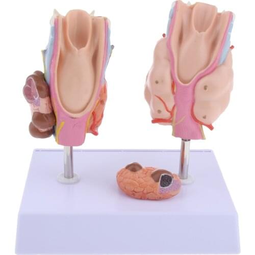 Enlarged Teaching Material for Anatomy Diseases of The Human