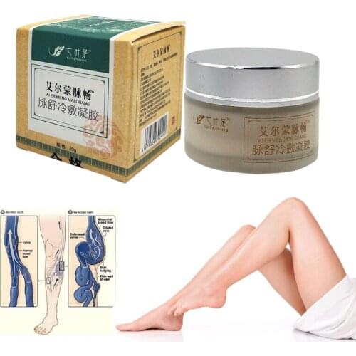 Varicose Veins Cream Of Varicose Veins Medical Spider Veins Treatment Chinese Herbal Medicine Varicose Veins Ointmen 20g