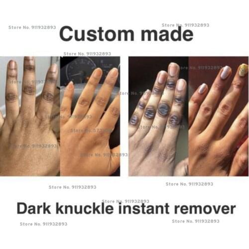 Knuckle Whitening, Dark Knuckle Remover Oil, Knuckle Eraser With Kojic Acid