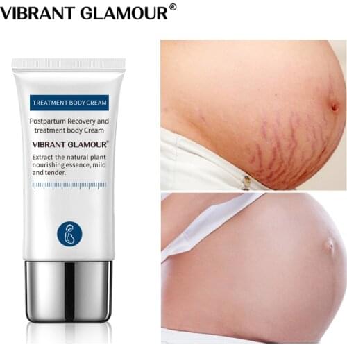 VIBRANT GLAMOUR Crocodile Stretch Marks Cream Remove Pregnancy Scars Postpartum Scar Repair Wrinkles Lift Firming Body Care 30g