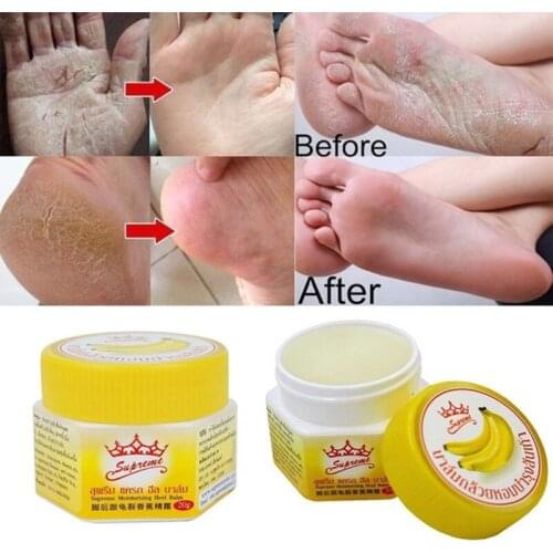 Hand Foot Heel Nourish Anti Fungal Anti Chapped Odor Treatment Banana Oil Repair Anti-Drying Crack Cream Dead Skin Remover Care