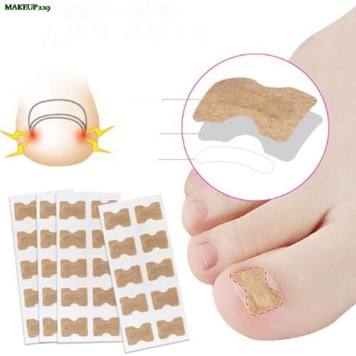 Nail Art Ingrown Correction Sticker Foot Care Pedicure Tool Fixer Paronychia Recover Toenail Elastic Patch Corrector 10Pcs/50Pcs