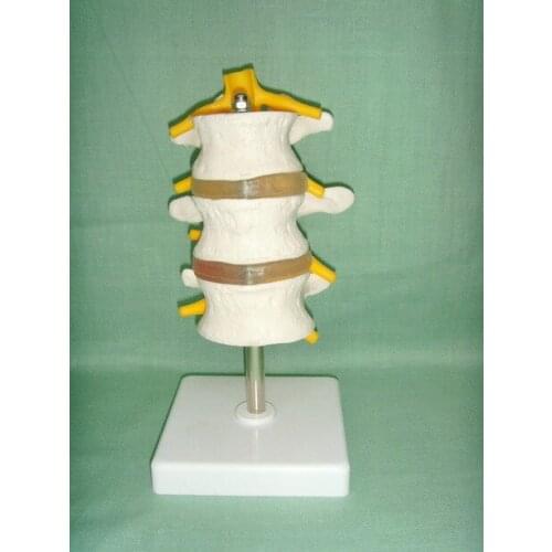 1:1 Natural Size PVC Three Section Lumbar Spine Skeleton Model with Stand Skeleton Model Medical Science Teaching Resource
