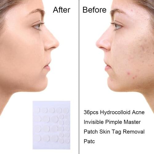 24/36pcs Hydrocolloid Invisible Acne Patch Fine Highly Permeable Polyurethane Film Facial Pimple Blemish Removal Sticker