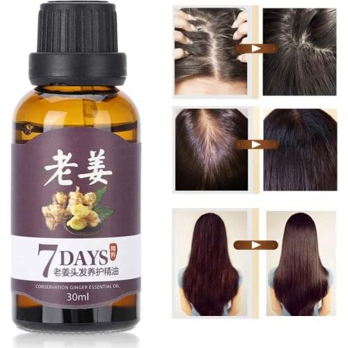 30ML Fast Growth Hair Essence Healthy Natural Anti-Hair Loss Oil Dense Hair Growth Liquid Dense Anti Preventing Hair Loss Gifts