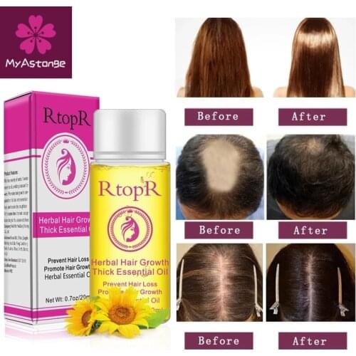 Herbal Hair Growth Anti Hair Loss Liquid Promote Thick Fast Hair Growth Treatment 20ml Essential Oil Health Care Beauty Essence