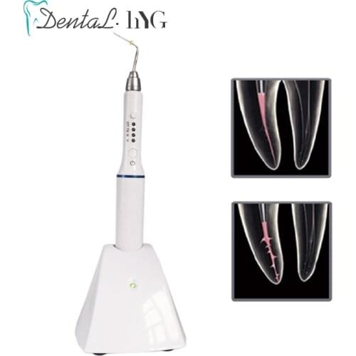 Dental Wireless Cordless Obturation Pen Endo System Hot Melt Gutta Percha Filling System with 4 Endo Heated Tips