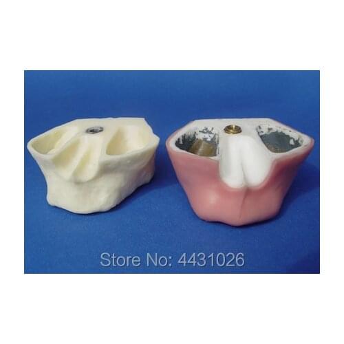 ENOVO Practice of oral dental implant practice on maxillary sinus enhancement exercise model