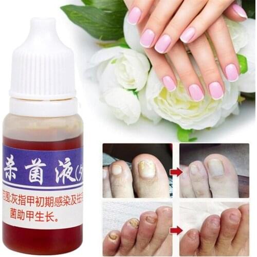 10ml Nail Repair Fungal Nail Treatment Remove Toe Onychomycosis Remover Serum Nail Fungus Repair Hand Foot Care Tools TSLM1