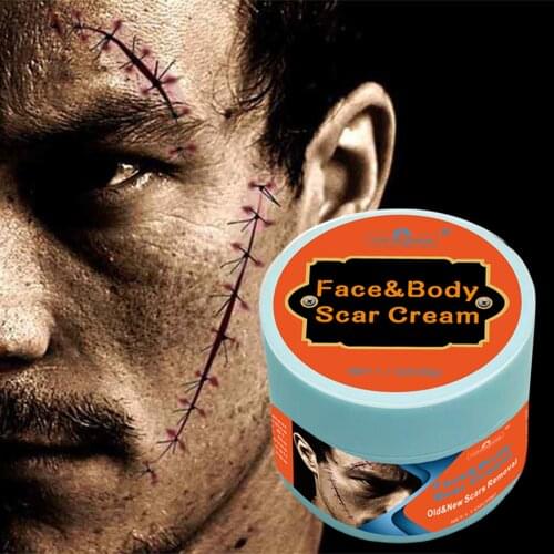 Effective 30g Acne Scar Removal Cream Pimples Stretch Marks Face Gel Remove Acne Smoothing Whitening Moisturizing Body Skin Care