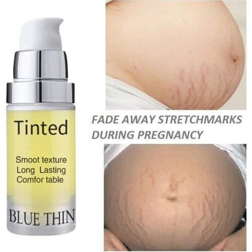 10ml Repair Cream Removal Fade Stretch Marks Scar Obesity Pattern Growth Pattern Gel Nourishing Maternity Body Skin Care
