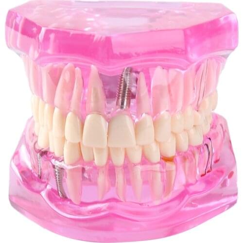 Dental Orthodontic Model PVC/Resin Oral Teeth Model for Oral Health Medical Teaching for Oral Tooth Modele