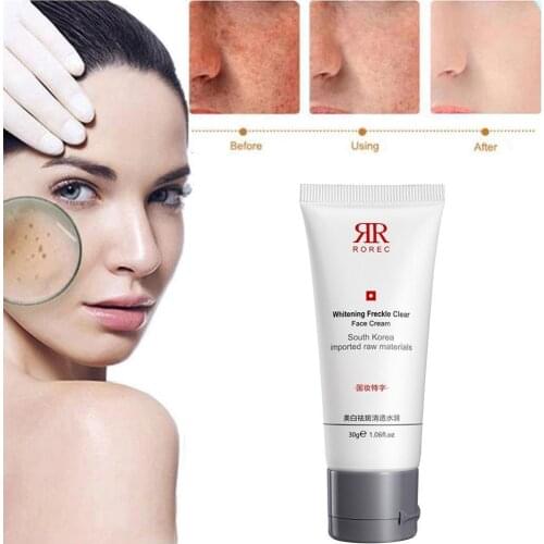 30ml Black Skin Whitening Cream Korean Skin Care Dark Spot Remover Freckle Cream Pigmentation Moisturizing Niacinamide