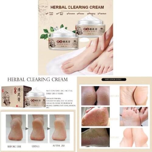 Newest Herbal Anti-Drying Crack Foot Cream Effective Anti Fungal Moisturizing Foot Skin Care