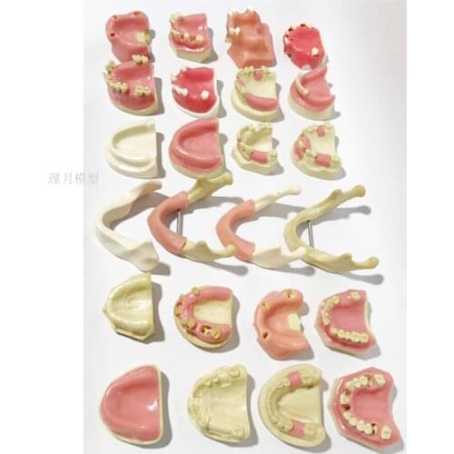 Dental materials dental model oral implant surgery maxillary sinus dental supplies equipment tools soft gums