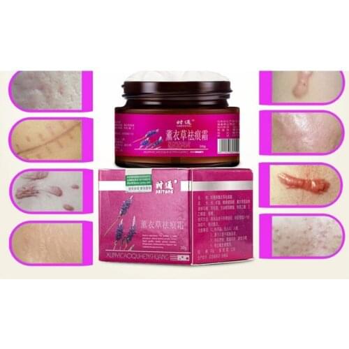 Scar-removing To Repair Scars Of Pregnancy scar removal cream for old scars Body Care 30g