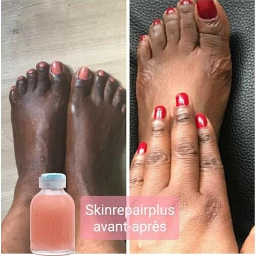 Strong Hand and Feet Lightening Whitening Cleansing Serum To Clean Up Dark Knuckles Melting and brightening the skin 30ml