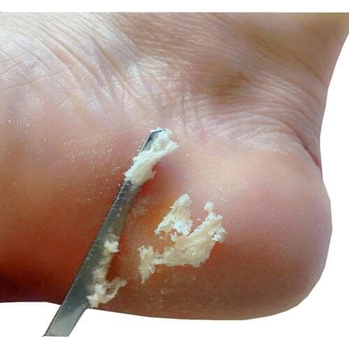 1 pc Professional Foot Scraper Stainless Steel Foot Care Pedicure Scraper Portable Nail Clipper Exfoliating Tool