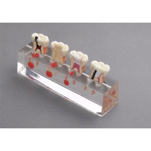 Model of dental materials m4018