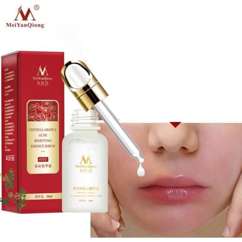 Acne Treatment Face Serum Centella Asiatica Oil Control Shrink Pores Scar Essence Whitening Moisturizer Skin Care MeiYanQiong