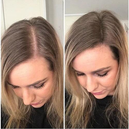 Ombre Ash Blonde Toupee Hair For Women Human Hair Topper Toupee 613 Closure Wig Kosher European Remy Hair Top Piece