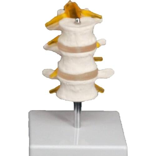 Life Size Three Section Lumbar Spine Skeleton Model with Stand Medical Teaching Training Aid