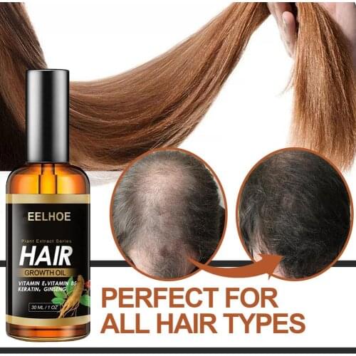 Hair Growth Essence Hair Care Hair Growth Essential Oil Essence Hair Loss Liquid Treatment Health Care Beauty Dense Hair Growth