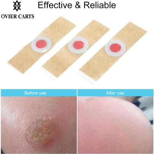 12PCS Corn Remover Wart Remover Foot Corn Remover Pads Corn & Callus Remover Cushions Corn Plaster with Hole for Foot Care