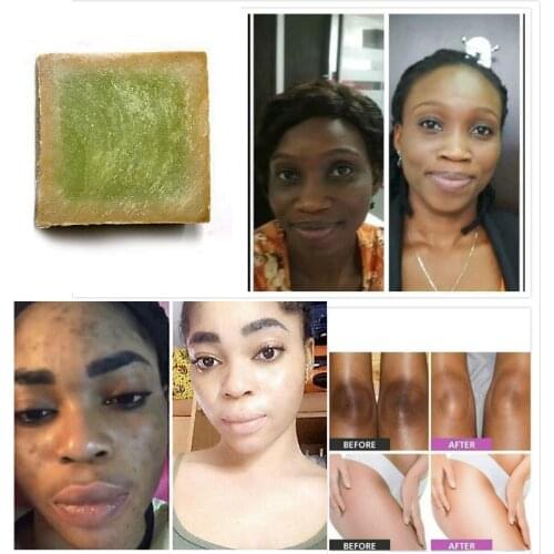 Laurel oil Neutral Soap Gluta Whitening Reduce Dark Spots Soft Skin Cleaning Elbow Dark Knee Knuckles 45g