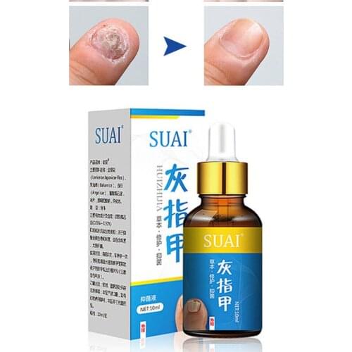 Nail Fungal Treatment Onychomycosis Effective Feet Care Herbs Essence Toe Essence Toe Nail Fungus Removal Gel Whitening Bright