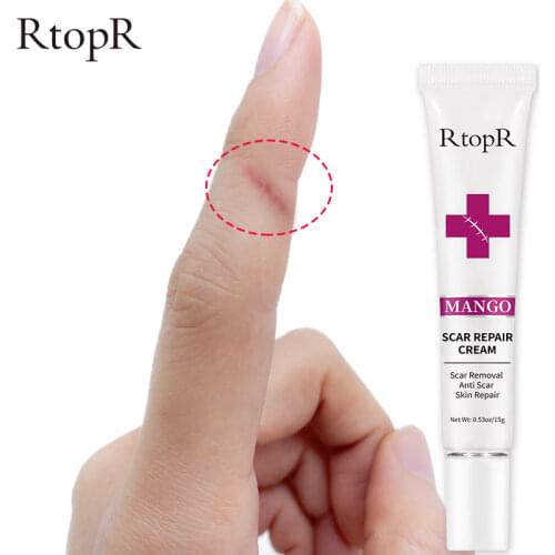 RtopR Acne Scar Stretch Marks Remover Cream Skin Repair Face Cream Acne Spots Acne Treatment Blackhead Whitening Cream Skin Care
