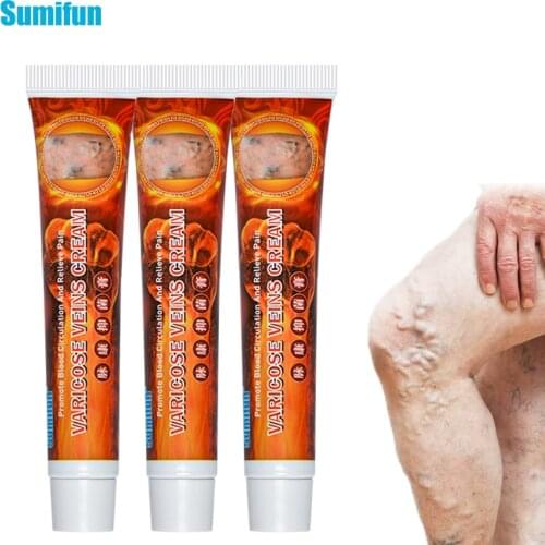Sumifun 3Pcs Varicose Veins Treatment Cream Vasculitis Phlebitis Spider Pain Relief Ointment Chinese Herbal Medical Plaster