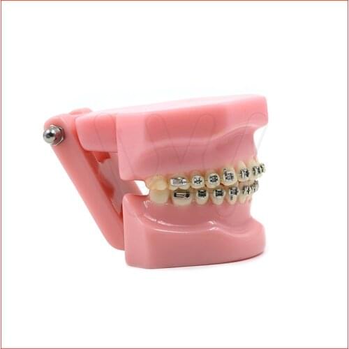 Dental Orthodontics Typodont Teeth Model Metal Brace bracket Typodont with Arch Wire