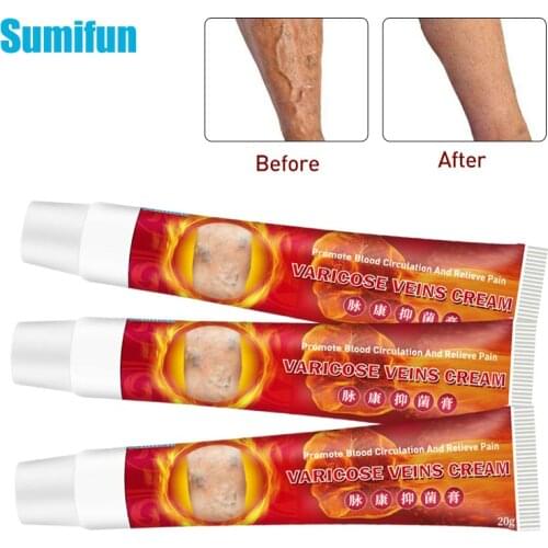 3pcs 100% Original New Varicose Veins Treatment Cream Vasculitis Phlebitis Spider Pain Relief Ointment Medical Plaster Skin Care