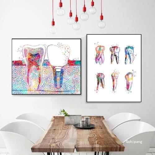 Dental Art Tooth Implant Canvas Painting Dentist Picture Wall Art Print Medicine Hygienist Poster Tooth Watercolor Clinic Decor