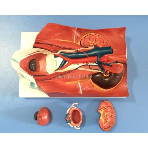 Urinary System Model,Urinary System After Abdominal Wall Model
