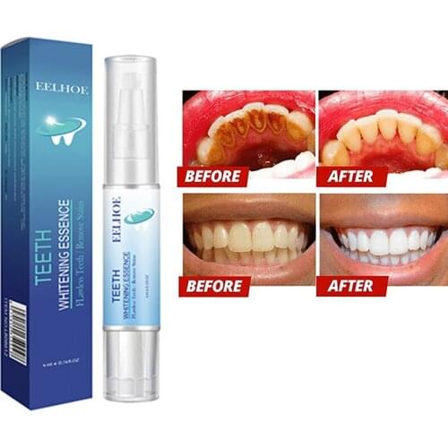 EELHOE Tanden Whitening Pen Cleaning Serum Verwijderen Plaque Vlekken Gereedschap Witter Tanden Mondhygiëne Tand Whitening Pen