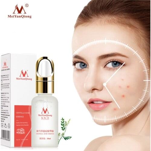 Effective Acne Removal Serum Anti-acne Repair Fade Acne Spots Oil Control Shrink Pores Whitening Moisturizing Face Gel Skin Care