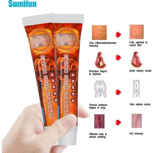 SMF 2020 2Pcs New Varicose Veins Treatment Cream 100% Original Vasculitis Phlebitis Spider Pain Relief Ointment Medical Plaster