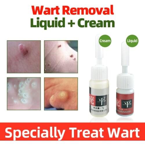 Hou Wart Remove Antibacterial Ointment And Pain Relief Liquid Remove Meat thorn Treatment Warts Toe Calluses Thorn Hou
