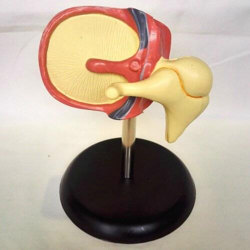 Human cochlear model enlargement Medical teaching of ear anatomy