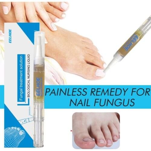 10ml Nail Fungal Treatment Feet Care Nail Fungus Removal Gel Anti Paronychia Onychomycosis Nail Care Nail Treatment Pen OilTSLM1