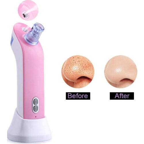 Вакуумные очистители пор Pinkiou China At AliExpress