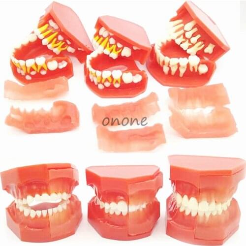 1pcs Dental Tooth Teeth Anatomical Anatomy Model Children Dental Model Baby teeth mold